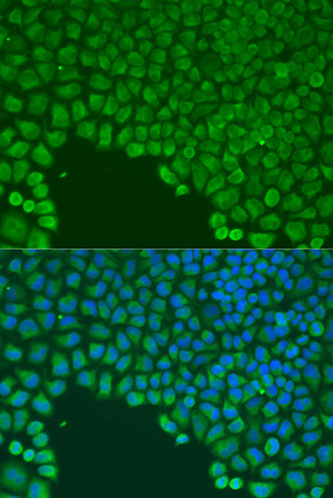 CDC42 Polyclonal Antibody (E-AB-66526)