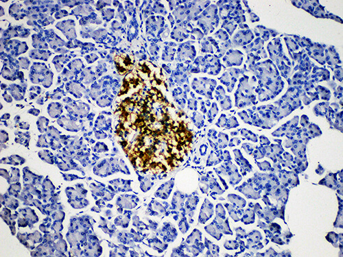 PGP 9.5 Monoclonal Antibody (ELAB6646-M)