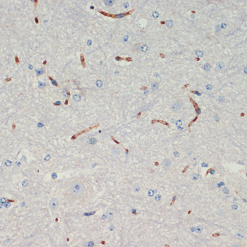 THBS1 Polyclonal Antibody (E-AB-67003)