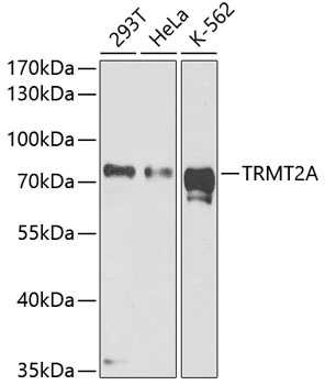 TRMT2A Polyclonal Antibody (E-AB-63832)