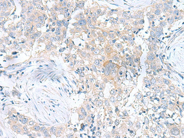 UBE2F Polyclonal Antibody (E-AB-53067)