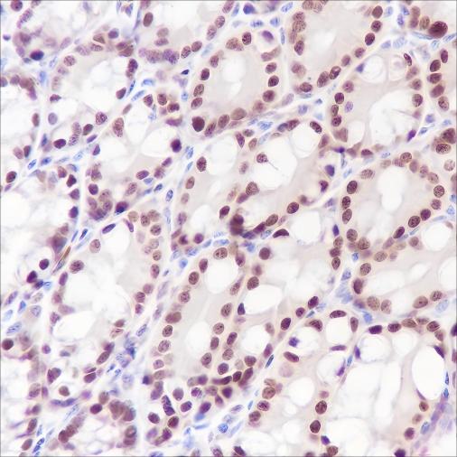 Recombinant Ku80 Monoclonal Antibody (AN301584L)