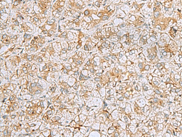 FERMT1 Polyclonal Antibody (E-AB-52109)