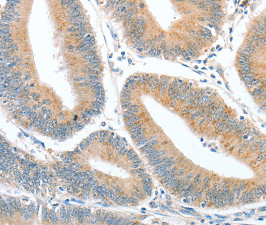 CKAP2 Polyclonal Antibody (E-AB-14876)