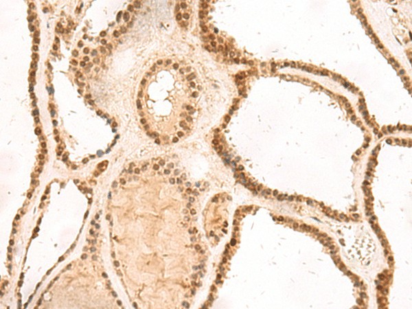 MKX Polyclonal Antibody (E-AB-18993)