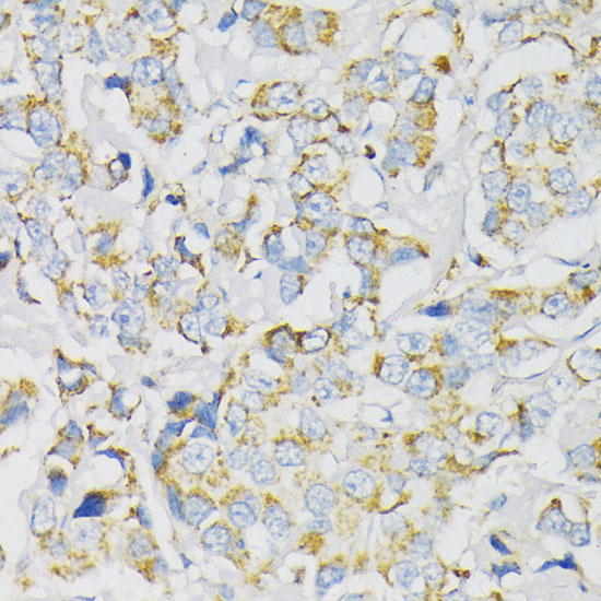 ATP5J Polyclonal Antibody (E-AB-65449)
