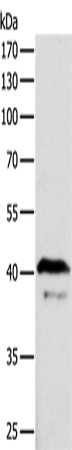 ADAP1 Polyclonal Antibody (E-AB-10033)