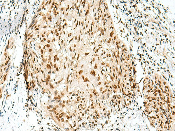 RBM10 Polyclonal Antibody (E-AB-18868)