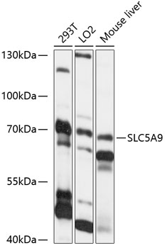 SLC5A9 Polyclonal Antibody (E-AB-91022)