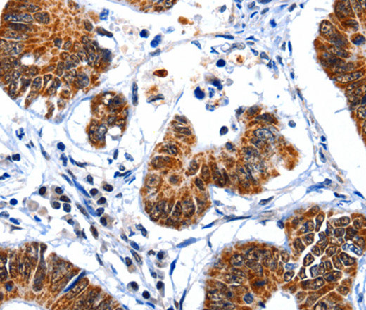 GSK3 alpha Polyclonal Antibody (E-AB-12494)