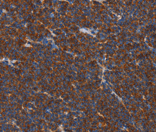 FNK Polyclonal Antibody (E-AB-14700)