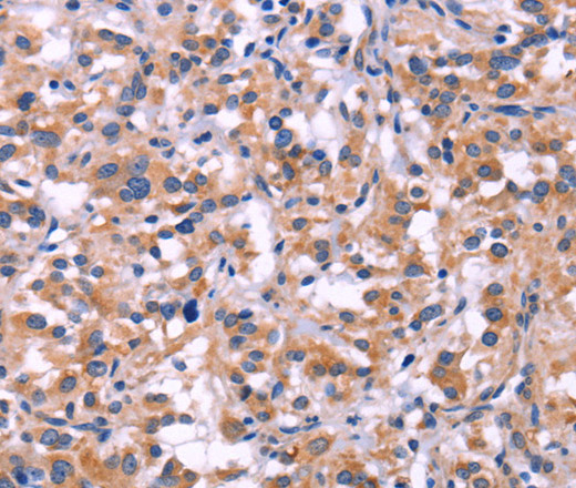 MMP14 Polyclonal Antibody (E-AB-10461)