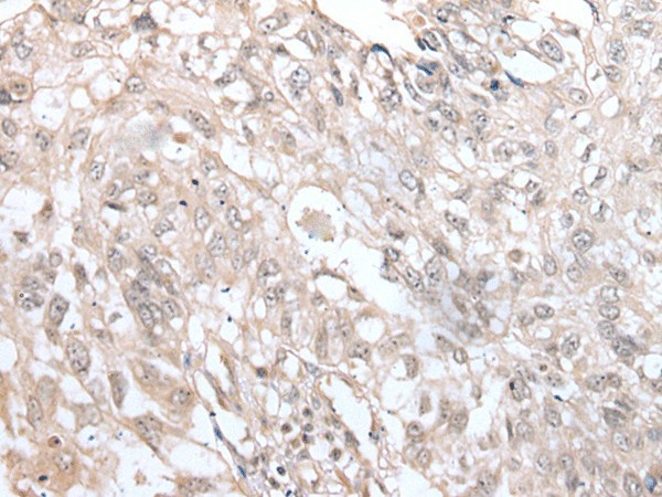 VRK3 Polyclonal Antibody (E-AB-52423)