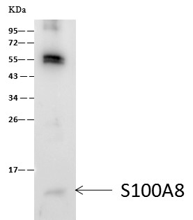 Recombinant S100A8 Monoclonal Antibody (AN300223P)
