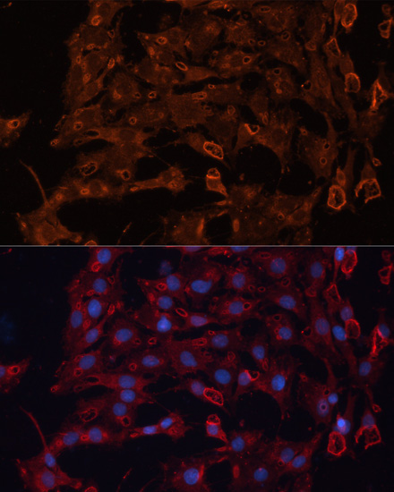 ABCB11 Polyclonal Antibody (E-AB-66326)