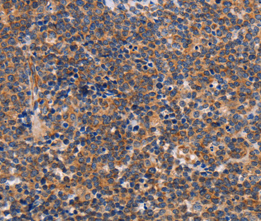 ALG9 Polyclonal Antibody (E-AB-14540)