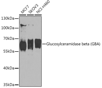 GBA Polyclonal Antibody (E-AB-93176)