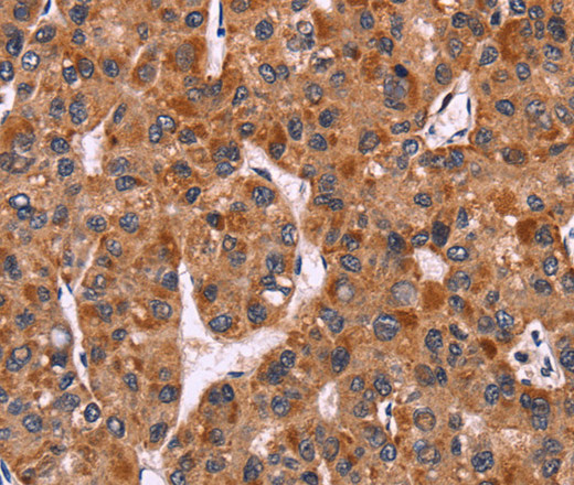 CARD11 Polyclonal Antibody (E-AB-14822)