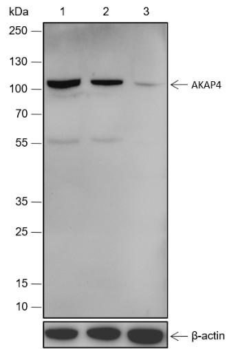 Recombinant AKAP4 Monoclonal Antibody (AN301786L)