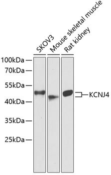 KCNJ4 Polyclonal Antibody (E-AB-64894)