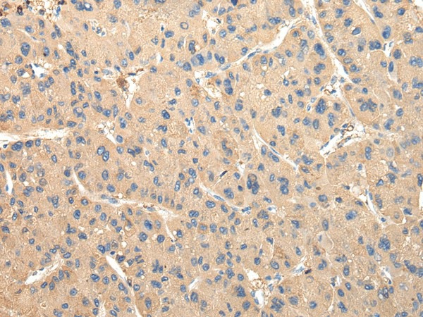DUSP11 Polyclonal Antibody (E-AB-17232)