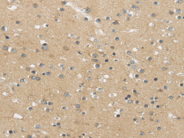 MPP6 Polyclonal Antibody (E-AB-17540)