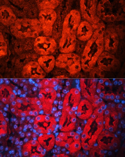 LCN2 Polyclonal Antibody (E-AB-60599)