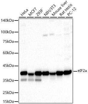 EIF2S1 Polyclonal Antibody (E-AB-62069)