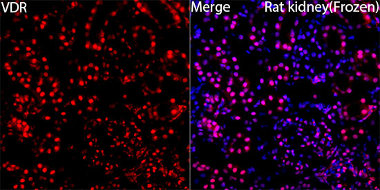 VDR Polyclonal Antibody (E-AB-93065)