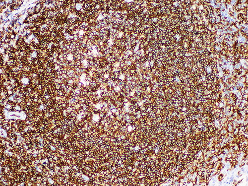 CD45 (LCA) Monoclonal Antibody (ELAB6018-M)
