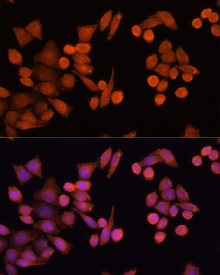 PLA2G4D Polyclonal Antibody (E-AB-66466)