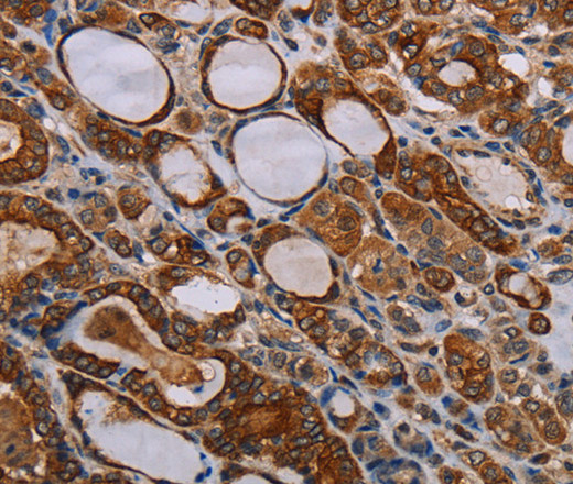 FABP3 Polyclonal Antibody (E-AB-15493)