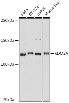 KDM2A Polyclonal Antibody (E-AB-92104)