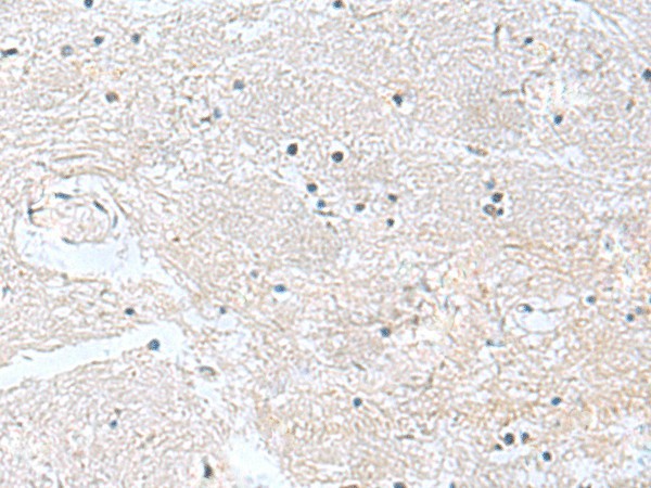 CACNB1 Polyclonal Antibody (E-AB-18257)