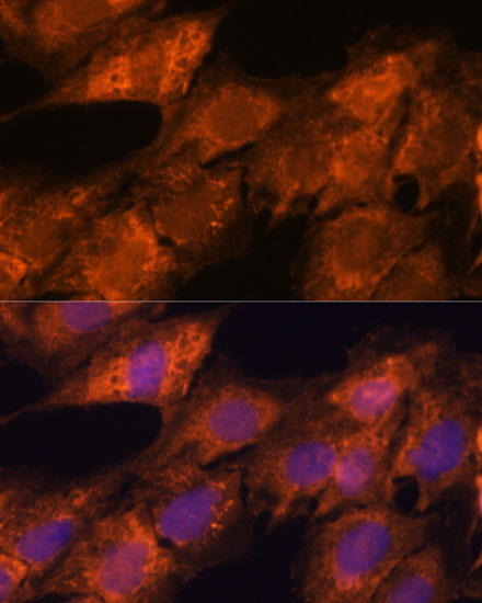 IPO4 Polyclonal Antibody (E-AB-66496)