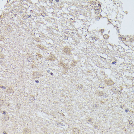 PPP2R5D Polyclonal Antibody (E-AB-66543)