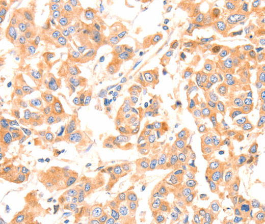 Factor XIIIa Polyclonal Antibody (E-AB-16093)