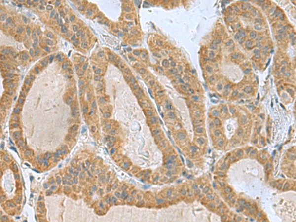 SLC30A6 Polyclonal Antibody (E-AB-19176)