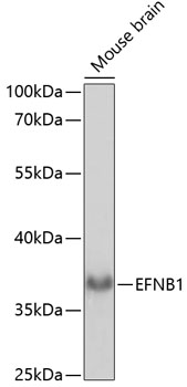 EFNB1 Polyclonal Antibody (E-AB-65036)