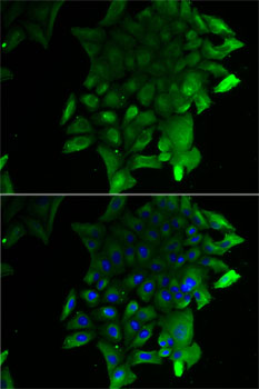 SEPSECS Polyclonal Antibody (E-AB-61526)