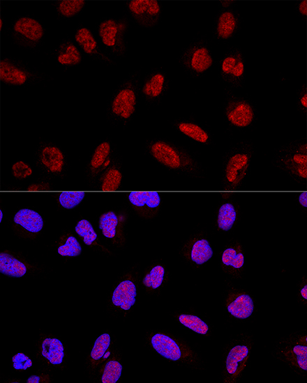 AKAP8 Polyclonal Antibody (E-AB-62339)