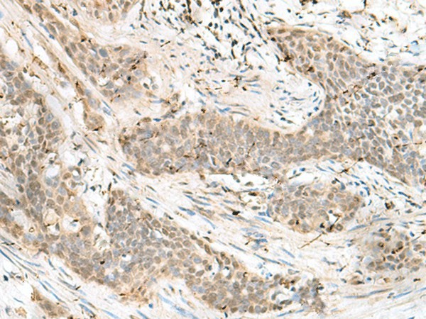 LIG4 Polyclonal Antibody (E-AB-52776)