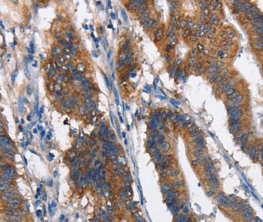 MAD2L1BP Polyclonal Antibody (E-AB-10441)