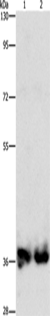 ASPA Polyclonal Antibody (E-AB-10966)