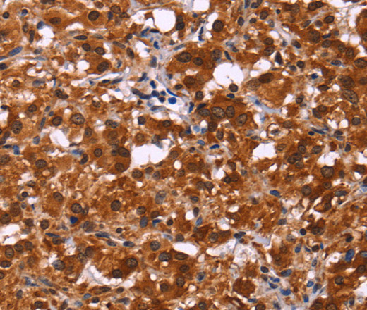 ART5 Polyclonal Antibody (E-AB-10858)