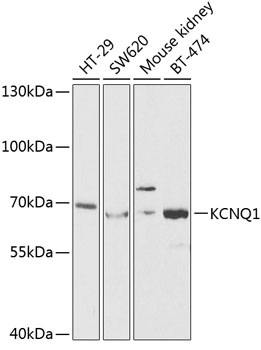 KCNQ1 Polyclonal Antibody (E-AB-60659)