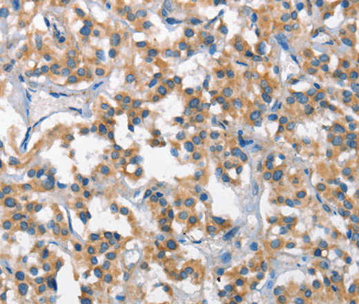 SCARB1 Polyclonal Antibody (E-AB-14121)