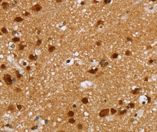 ZMAT3 Polyclonal Antibody (E-AB-15278)
