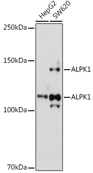 ALPK1 Polyclonal Antibody (E-AB-92221)