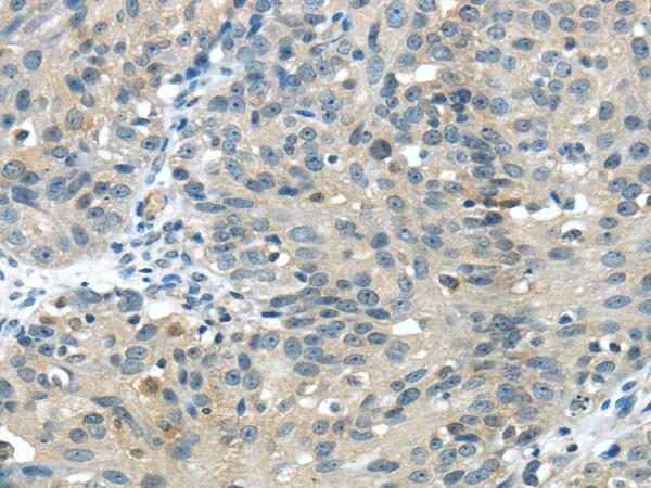 GLP2R Polyclonal Antibody (E-AB-16967)